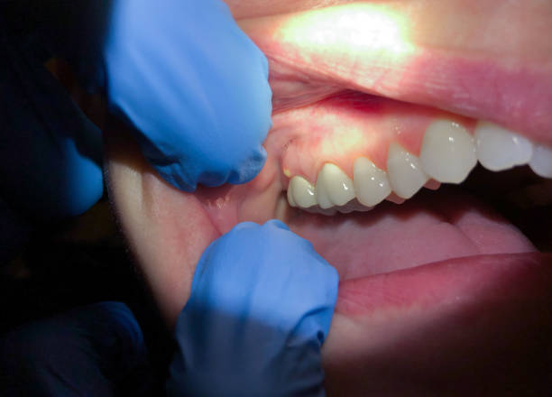 Best Emergency Gum Pain Relief  in Allendale, MI